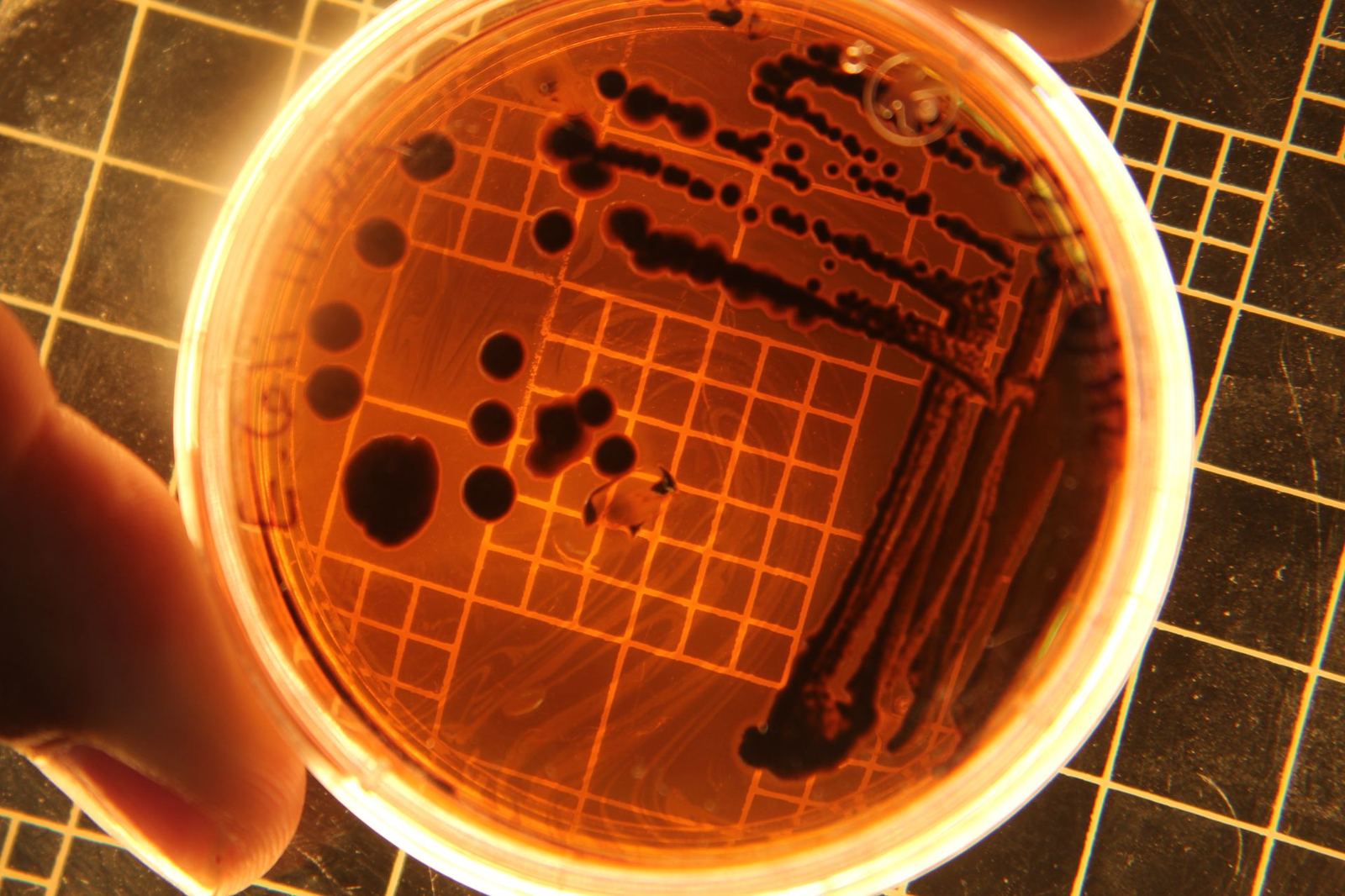Salmonella spp. Aranması