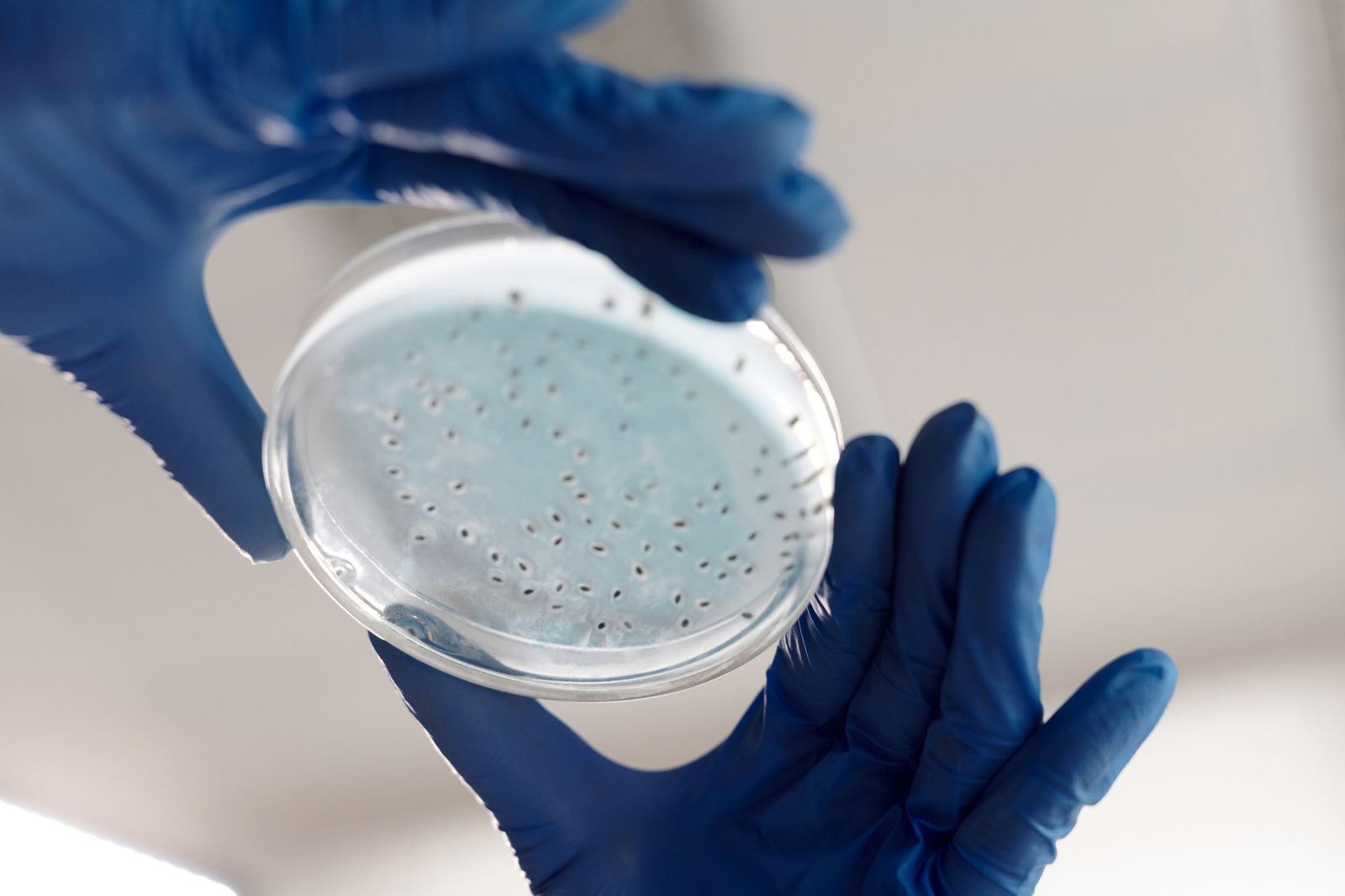 Listeria monocytogenes Arama ve Sayım